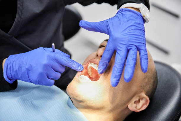 Best Emergency Tooth Extraction in Icard, NC